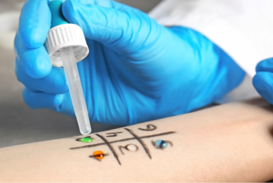 Banner qué es una alergia