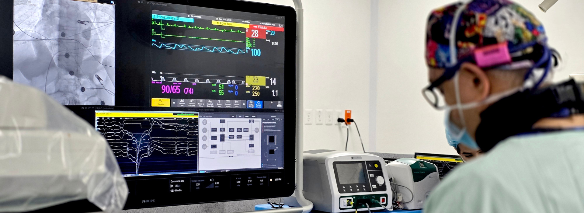 Fibrilación auricular: la arritmia silenciosa que multiplica el riesgo de infarto cerebral